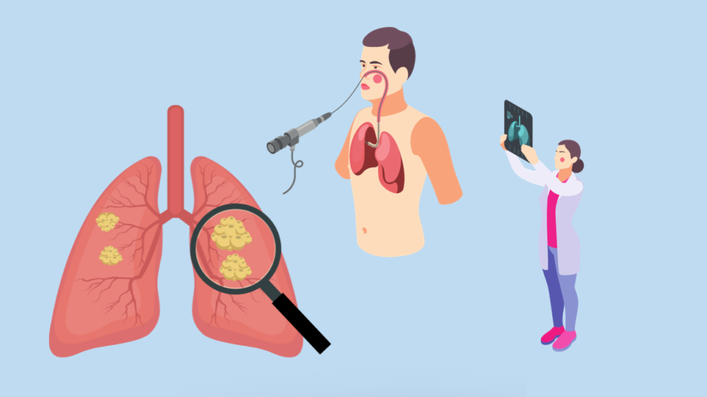 Tumor Marker Tests